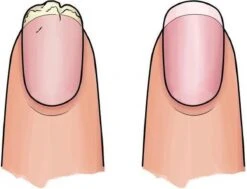 Herome 3 In 1 Manicure Nagelverzorging Set Blauw – Nagelset Voor Beschadigde Nagels - Nagelverharder, Nagellakremover En Nagelriemcreme - Set Van 3 15 Herome 3 In 1 Manicure Nagelverzorging Set Blauw – Nagelset Voor Beschadigde Nagels - Nagelverharder, Nagellakremover En Nagelriemcreme - Set Van 3 -Winkel Voor Persoonlijke Verzorging 1200x920 3