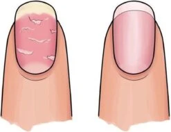 Herome 3 In 1 Manicure Nagelverzorging Set – Beschadigde Nagels – Nagelriemolie, Nagelriemcrème En Nagelverharder 19 Herome 3 In 1 Manicure Nagelverzorging Set – Beschadigde Nagels – Nagelriemolie, Nagelriemcrème En Nagelverharder -Winkel Voor Persoonlijke Verzorging 1200x925 1