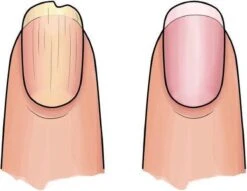 Herome 3 In 1 Manicure Nagelverzorging Set (Nail Essentials Geel) – Nagelset Voor Droge En Geribbelde Nagels – Base Coat, Vijl En Voedende Nagelolie – Voor Egale En Flexibele Nagels -Winkel Voor Persoonlijke Verzorging 1200x926 1