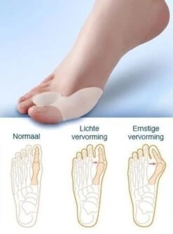 MYCARE+ Teencorrector - Wasbare Teencorrector - Gel-laag - 1 Paar - Pijn Verlichtend 11 MYCARE+ Teencorrector - Wasbare Teencorrector - Gel-laag - 1 Paar - Pijn Verlichtend -Winkel Voor Persoonlijke Verzorging 890x1200 3