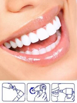 Merkloos HQ Tooth Polisher - Tanden Polijsten - Wittere Tanden - Tandsteen Tandplak Verwijderaar - Elektrisch 11 Merkloos HQ Tooth Polisher - Tanden Polijsten - Wittere Tanden - Tandsteen Tandplak Verwijderaar - Elektrisch -Winkel Voor Persoonlijke Verzorging 900x1200 5