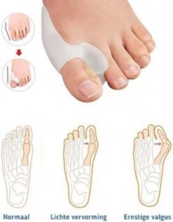 MYCARE+ Teencorrector - Wasbare Teencorrector - Gel-laag - 1 Paar - Pijn Verlichtend 12 MYCARE+ Teencorrector - Wasbare Teencorrector - Gel-laag - 1 Paar - Pijn Verlichtend -Winkel Voor Persoonlijke Verzorging 936x1200 2