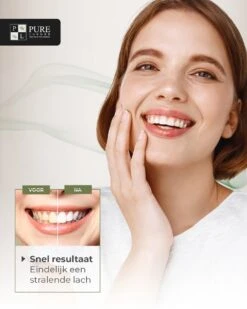 Tandenbleekset INCL. 14 Whitening Strips En 6 Gelpennen - ZONDER PEROXIDE - Teeth Whitening Kit - Tandenbleekset Met Ebook En Nederlandse Handleiding - Tandenblekers - Valentijnsdag Cadeau 18 Tandenbleekset INCL. 14 Whitening Strips En 6 Gelpennen - ZONDER PEROXIDE - Teeth Whitening Kit - Tandenbleekset Met Ebook En Nederlandse Handleiding - Tandenblekers - Valentijnsdag Cadeau -Winkel Voor Persoonlijke Verzorging 960x1200 3